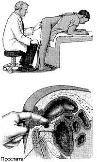 анальная стимуляция предстательной железы