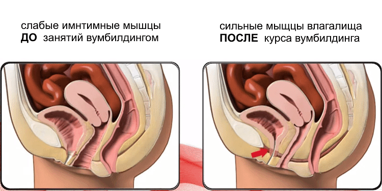 суть вумбилдинга в развитии мышц влагалища